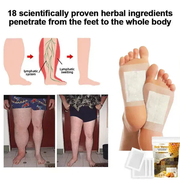 Bee Venom Foot Patches (Pack of 10) BUY 1 GET 1 FREE