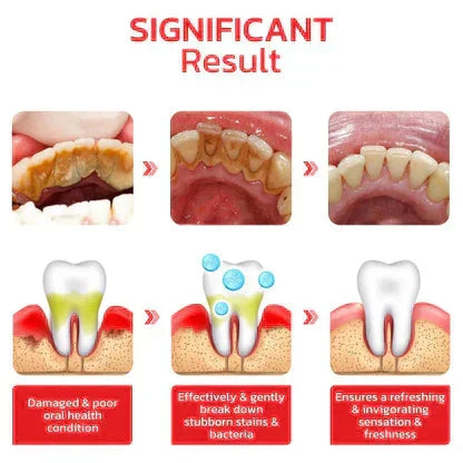 ✨SP-4 Probiotic Brightening & Stain Removing Toothpaste 🦷