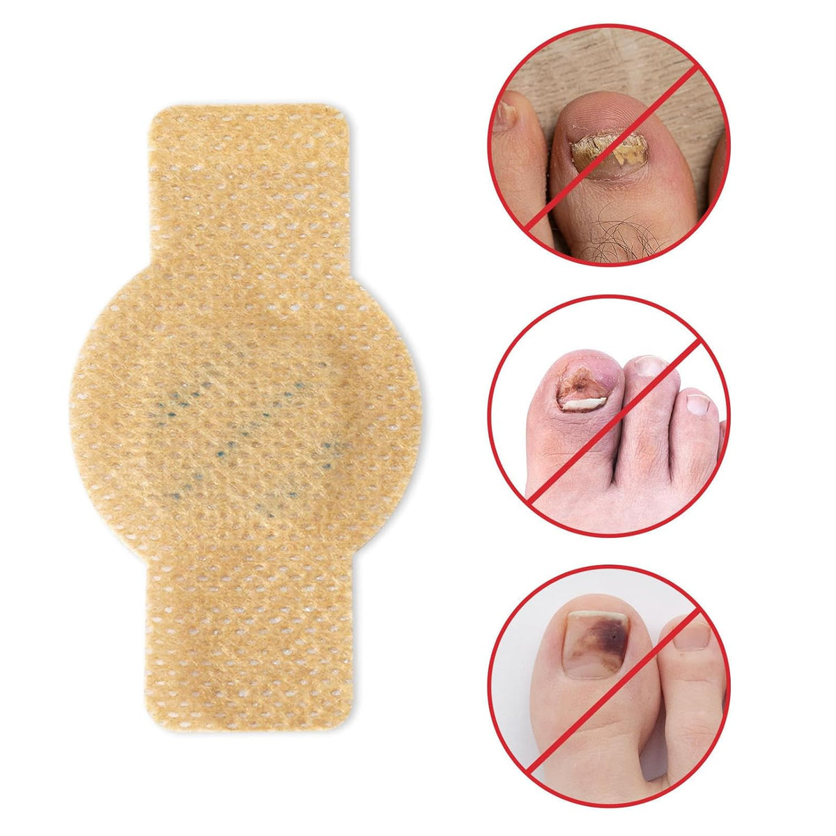 NailHeal™ - Fungal Nail Patches 🌿💅 ( Buy 1 Get 1 Free🔥🔥)